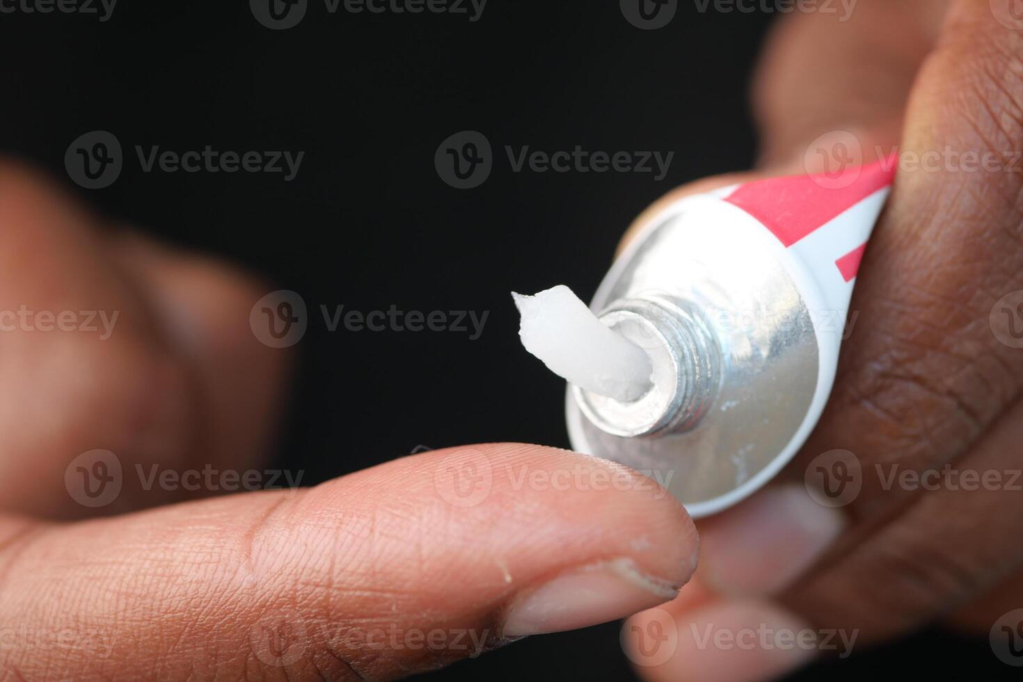 Applying cream or ointment using a tube can provide effective relief photo