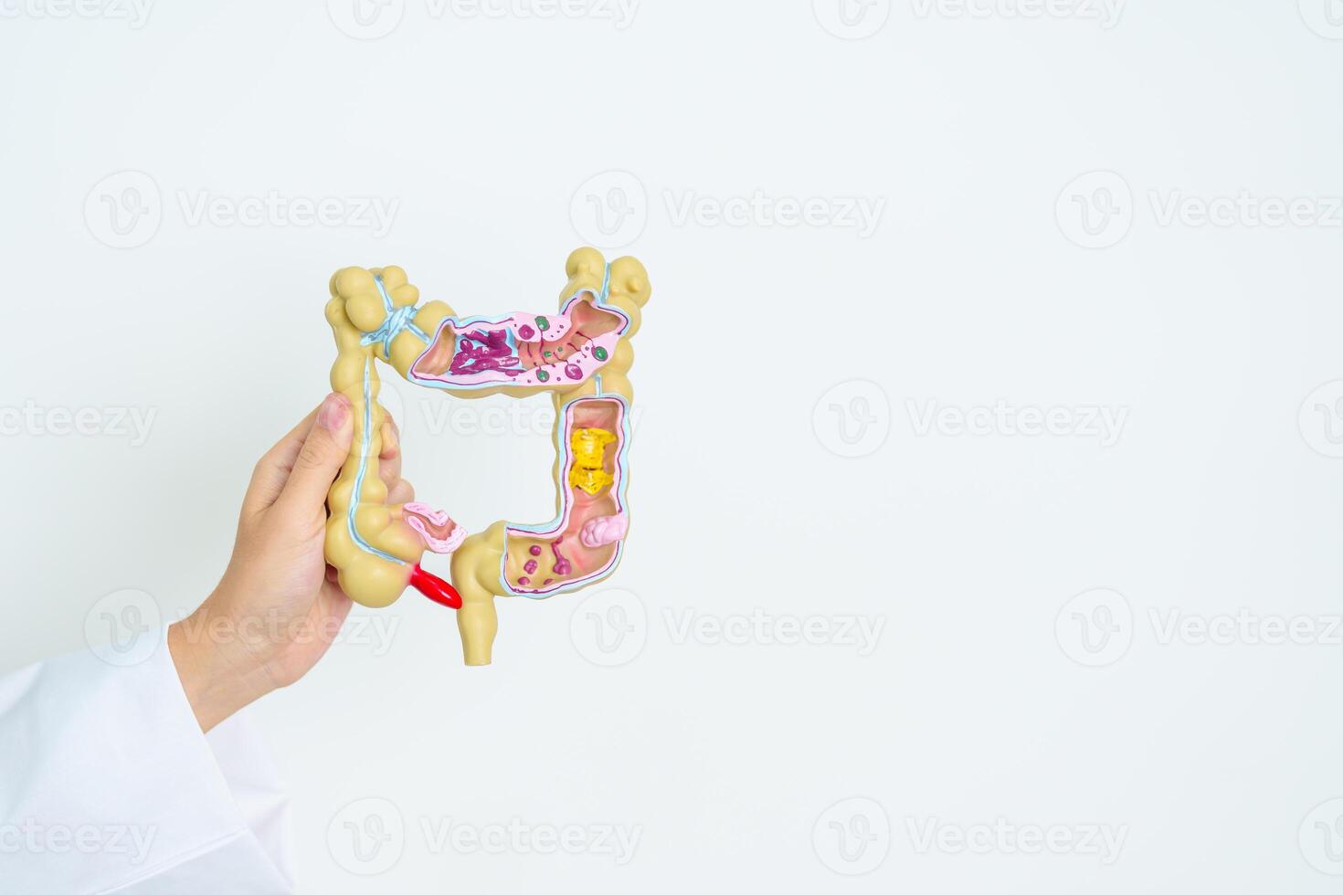 Doctor with human Colon anatomy model. Colonic disease, Large Intestine, Colorectal cancer, Ulcerative colitis, Diverticulitis, Irritable bowel syndrome, Digestive system and Health concept photo