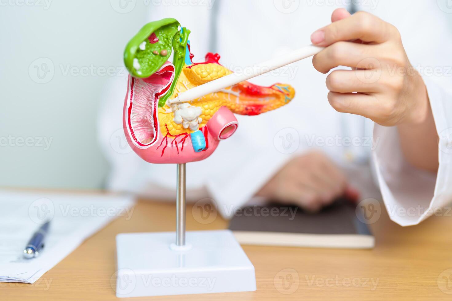 Doctor with human Pancreatitis anatomy model with Pancreas, Gallbladder, Bile Duct, Duodenum, Small intestine and tablet. Pancreatic cancer, acute pancreatitis and Digestive system photo