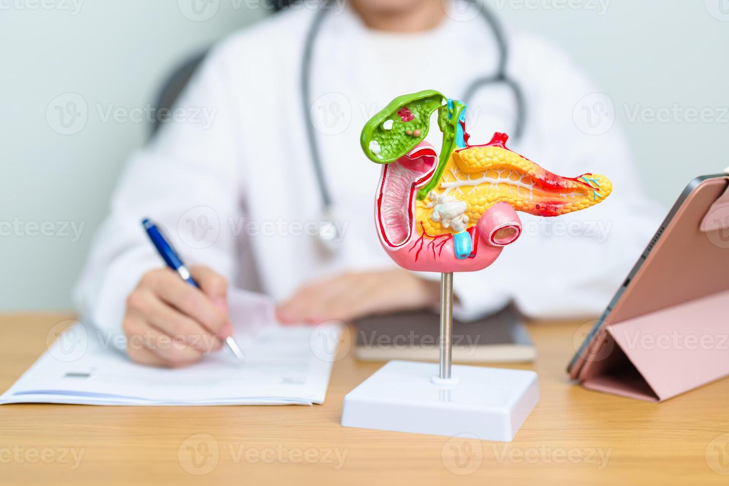 Doctor with human Pancreatitis anatomy model with Pancreas, Gallbladder, Bile Duct, Duodenum, Small intestine and tablet. Pancreatic cancer, acute pancreatitis and Digestive system photo