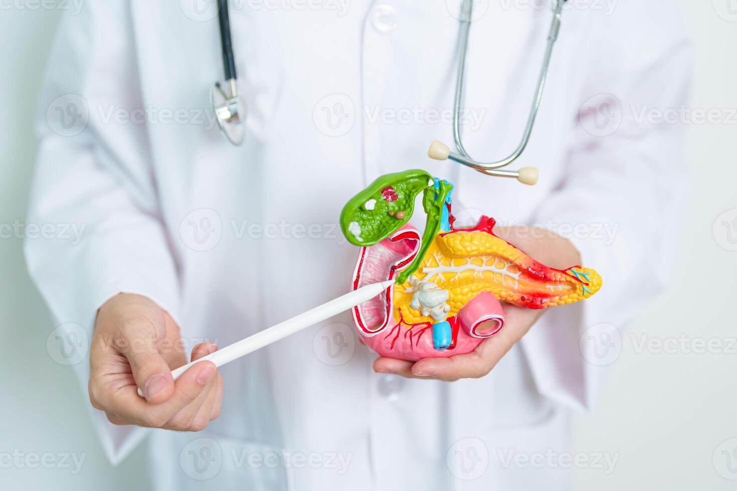 Doctor with human Pancreatitis anatomy model with Pancreas, Gallbladder, Bile Duct, Duodenum, Small intestine. Pancreatic cancer, Acute and Chronic pancreatitis, Digestive system and Health concept photo