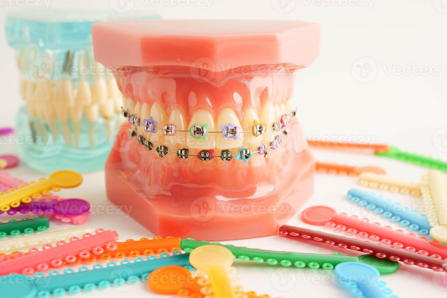 Orthodontic ligatures rings and ties, elastic rubber bands on orthodontic braces, model for dentist studying about dentistry. photo