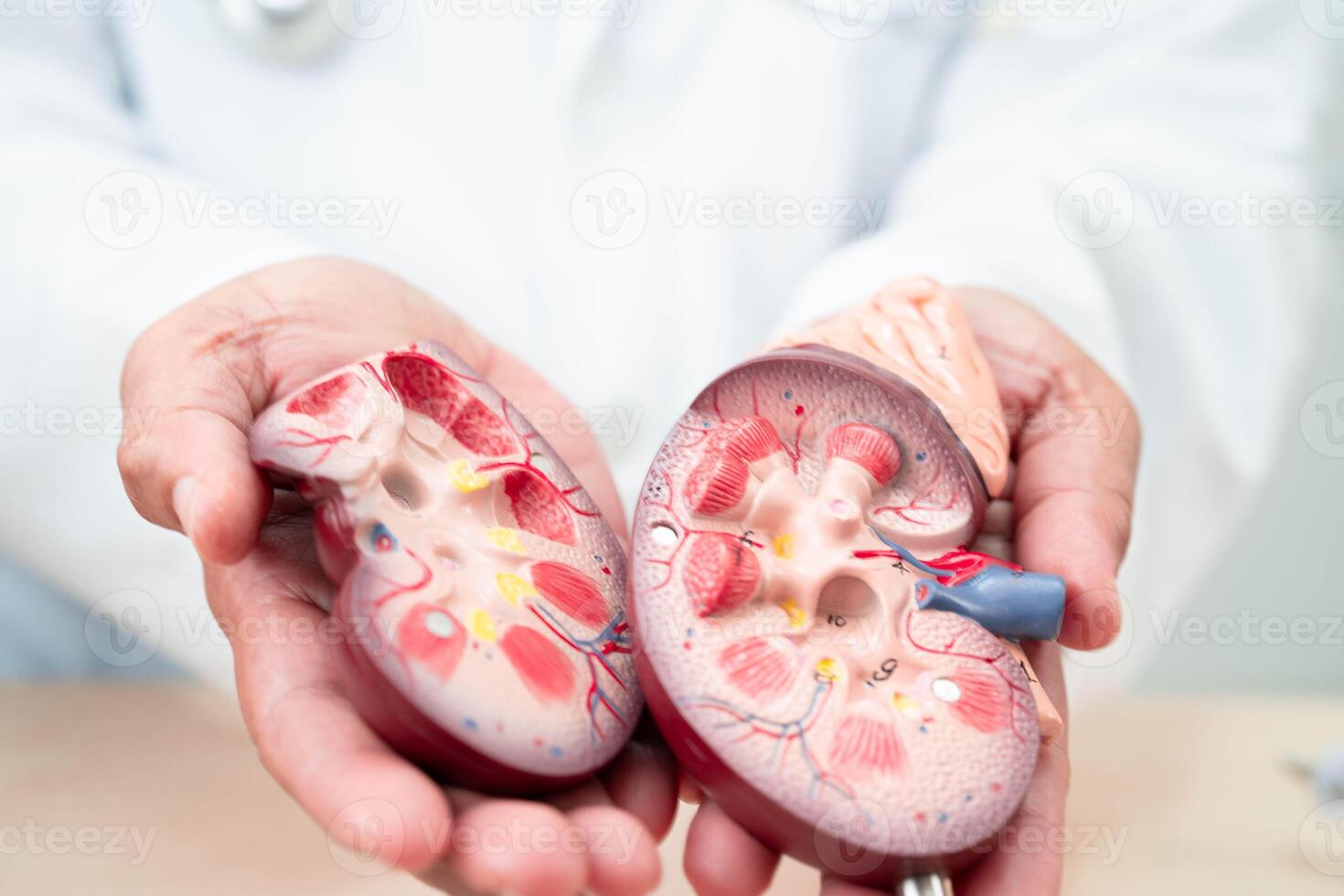 Chronic kidney disease, doctor with model for treatment urinary system, urology, Estimated glomerular filtration rate eGFR. photo
