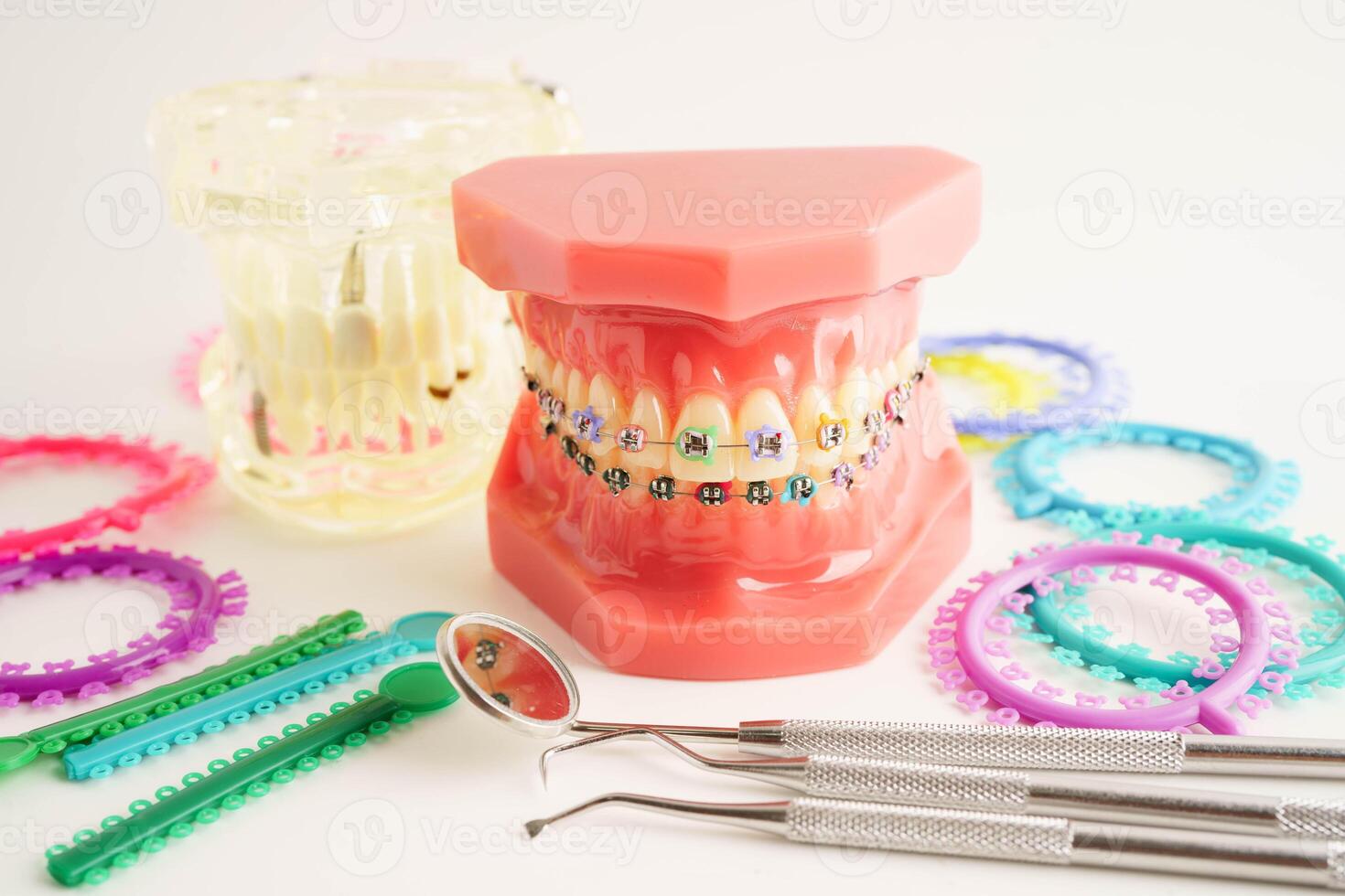Orthodontic ligatures rings and ties, elastic rubber bands on orthodontic braces, model for dentist studying about dentistry. photo
