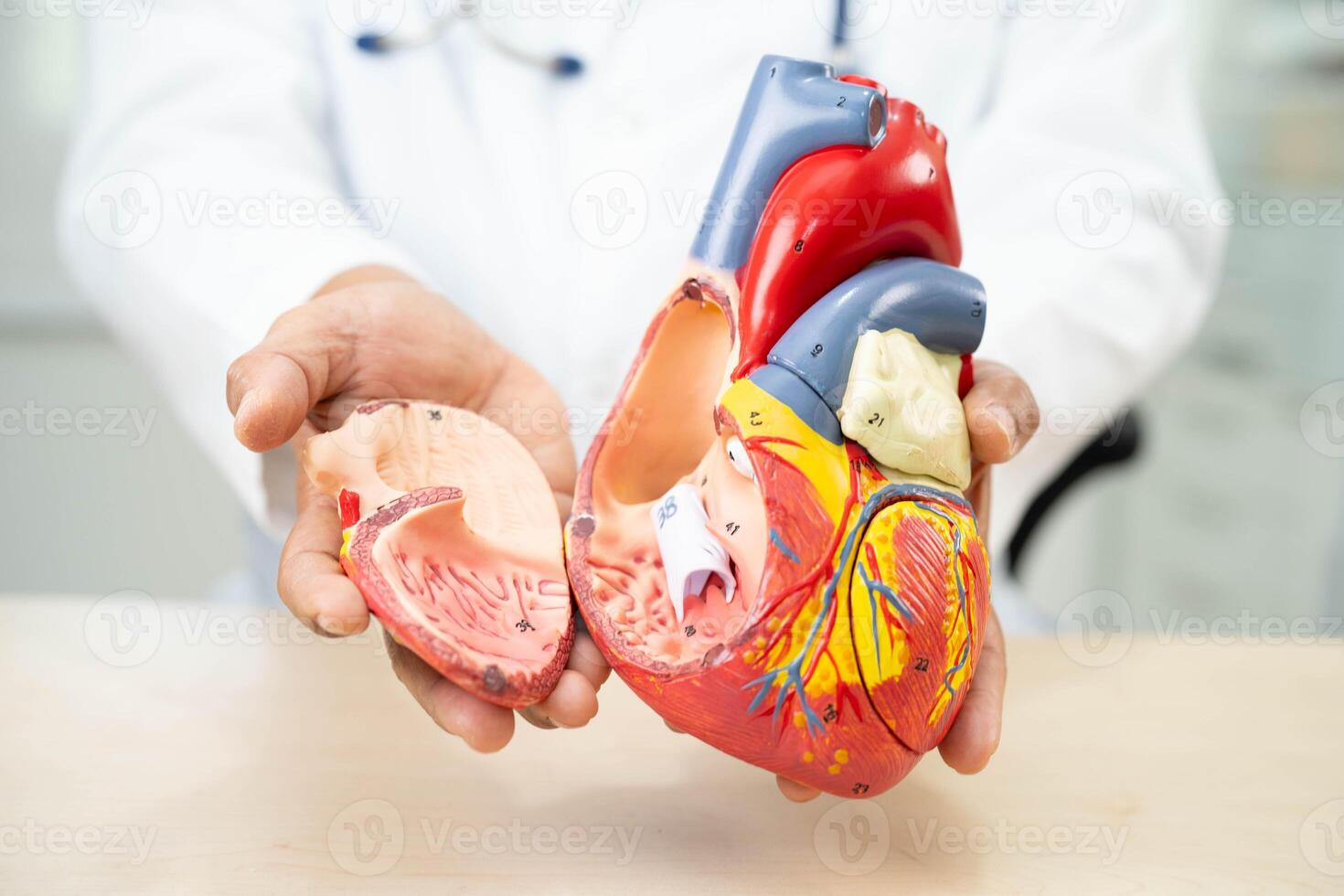 Cardiovascular disease CVD, doctor with heart human model anatomy for treatment patient in hospital. photo