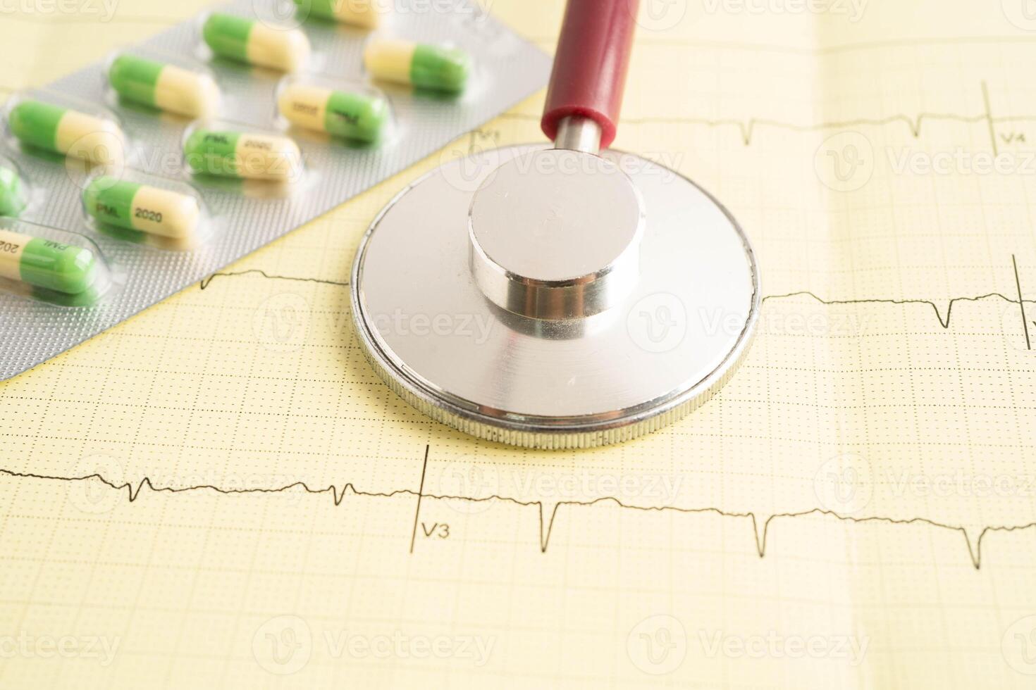 Stethoscope on electrocardiogram ECG, heart wave, heart attack, cardiogram report. photo