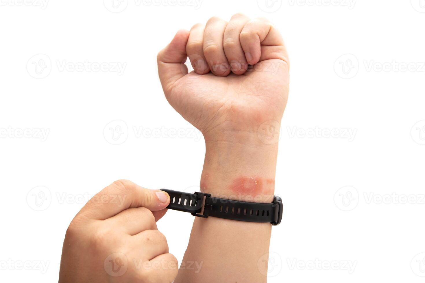 A man tightens a fitness bracelet with a silicone strap on his wrist, close-up. Concept of allergy and skin irritation from silicone watch strap, dermatitis. Copy space for text photo