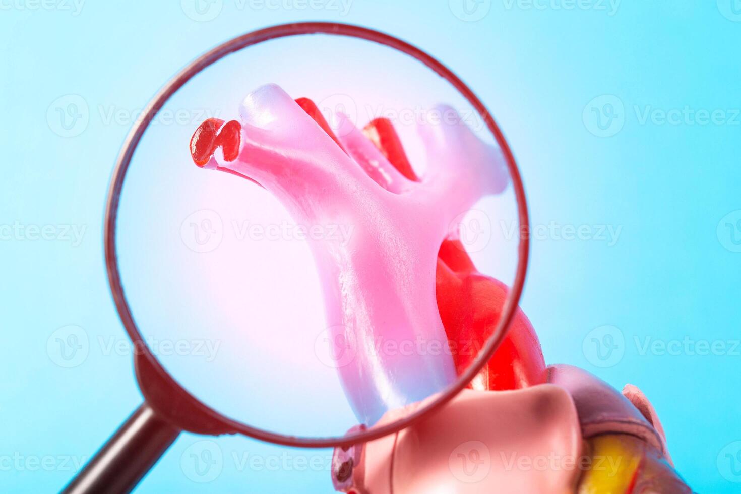 Inflamed coronary arteries of the heart under a magnifying glass on a blue background. Concept of atherosclerosis of the coronary arteries of the heart, risk of heart attack and angina, close-up photo