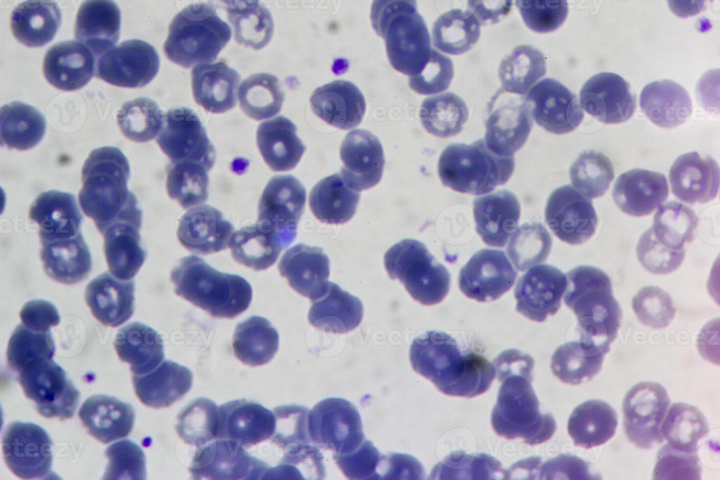Blood analysis under a microscope, close-up photo