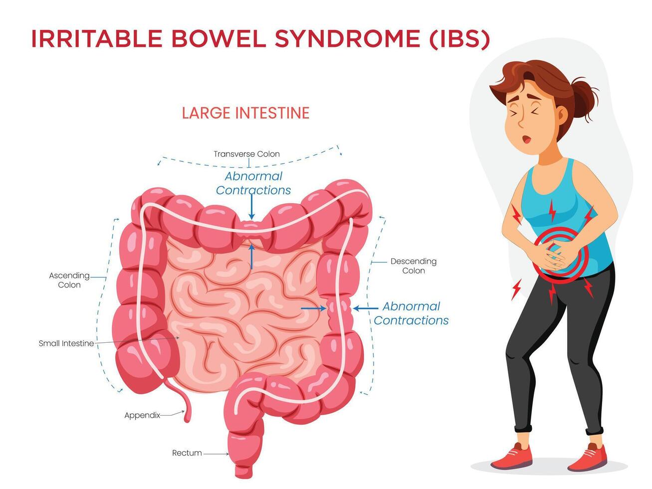 Irritable Bowel Syndrome Visualizing Symptoms with an Intestine Diagram vector
