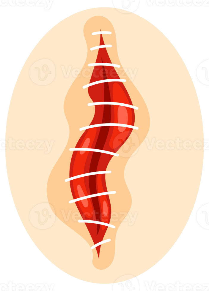 Collection of round icons representing various sutured wounds in different configurations, showing the process of surgical suture healing. png