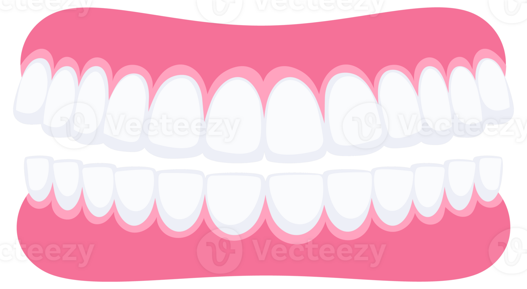 Teeth with braces. Orthodontic treatment. Tooth braces. Teeth with metal brackets png