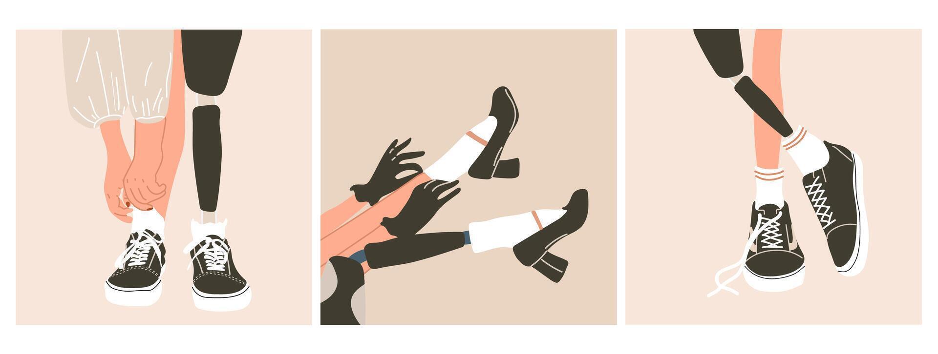Female legs, including a prosthetic leg, are styled with elegant shoes and lace socks in a retro fashion vector