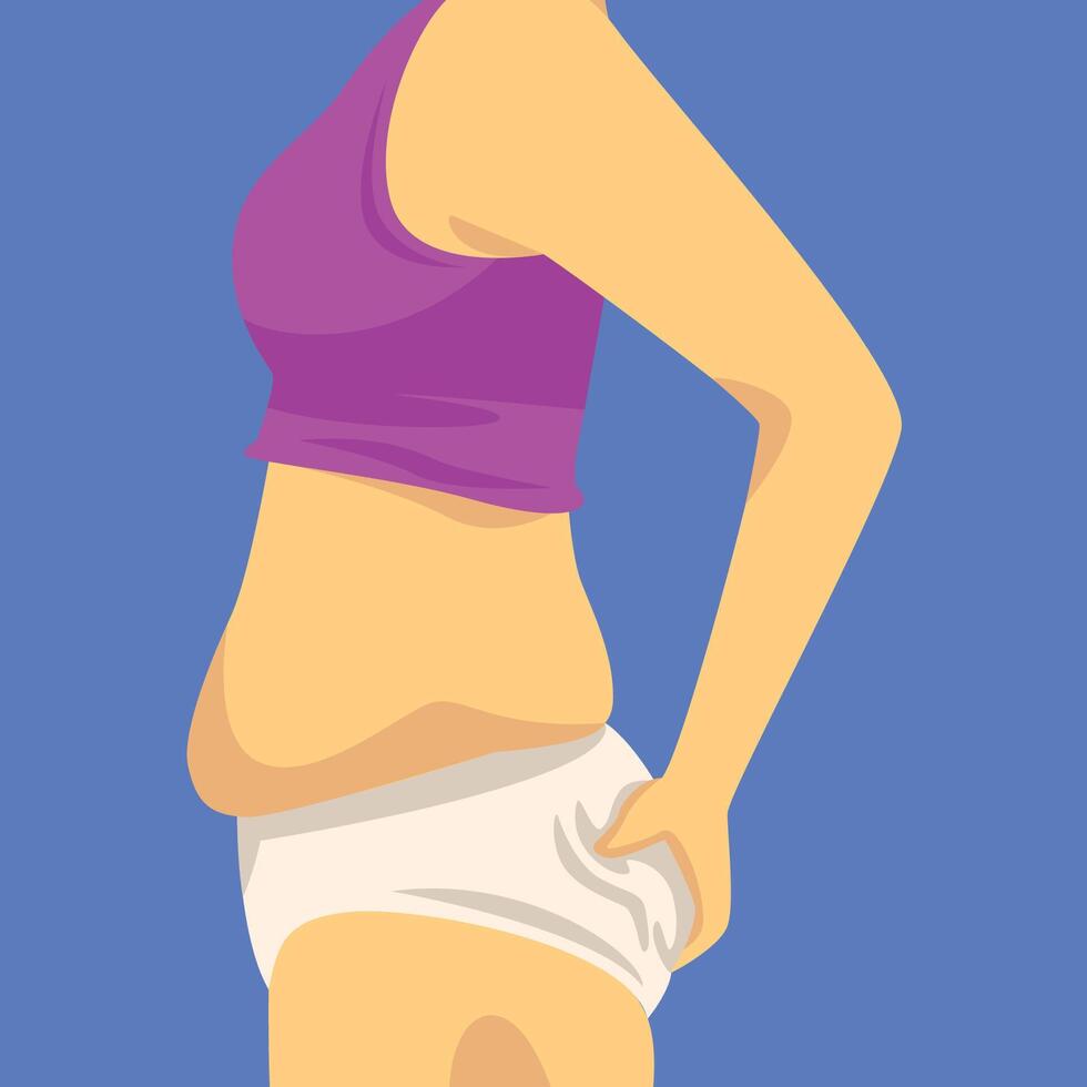 Part of Female Body with Fat Belly, Human Figure After Weight Loss, Side View, Obesity and Unhealthy Eating Problems Illustration vector
