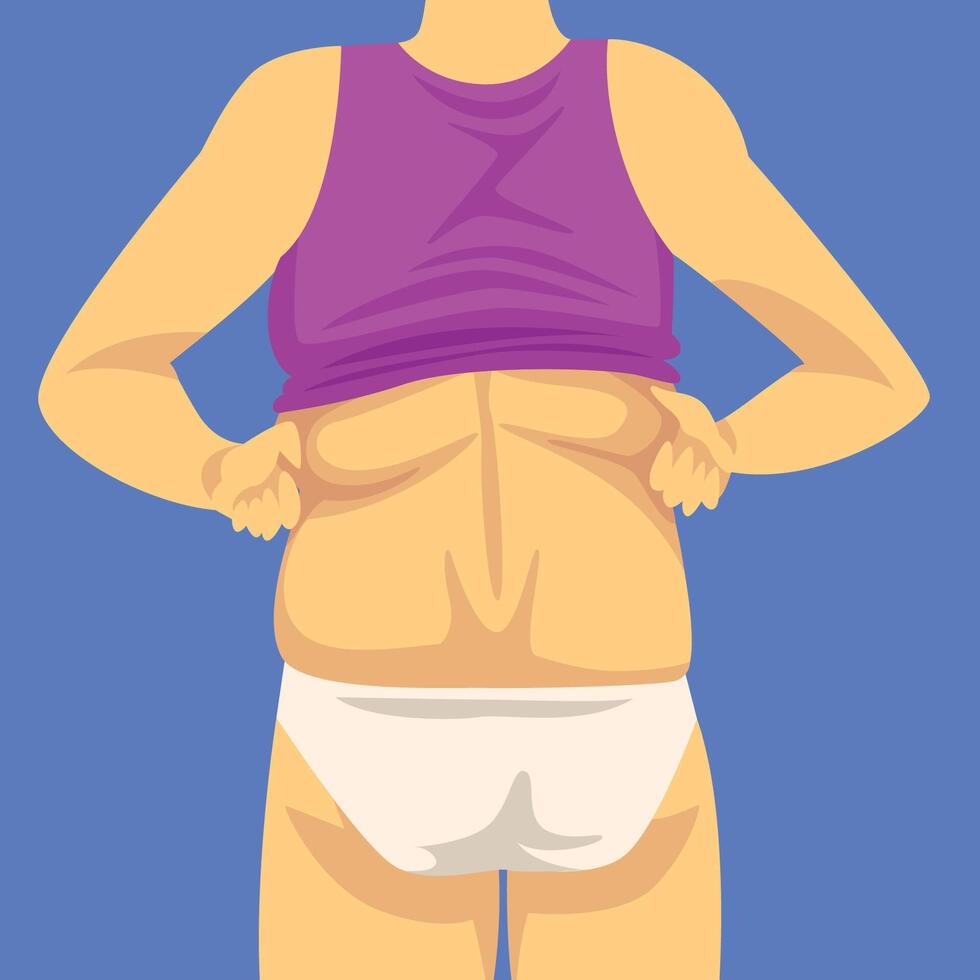 Part of Female Body, Human Figure After Weight Loss, Back View, Obesity and Unhealthy Eating Problems Illustration vector