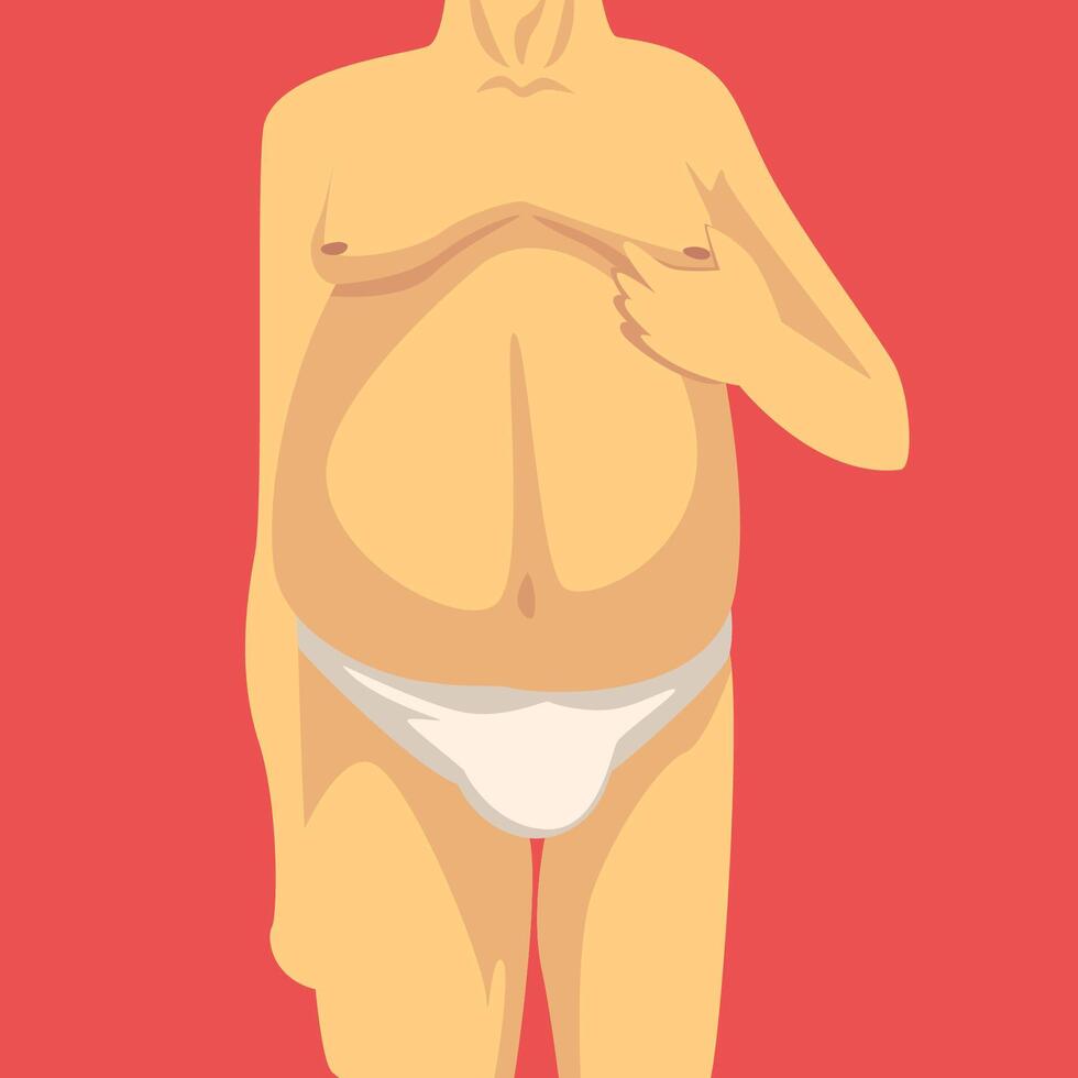 Male Torso with Fat Belly and Sagging Breast, Human Body After Weight Loss, Front View, Obesity and Unhealthy Eating Problems Illustration vector