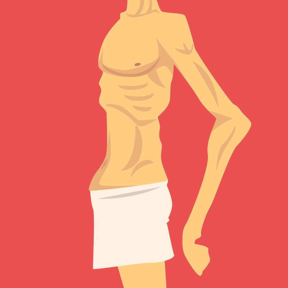Male Torso with Short Weight and Sagging Belly, Human Body After Weight Loss, Side View, Obesity and Unhealthy Eating Problems Illustration vector