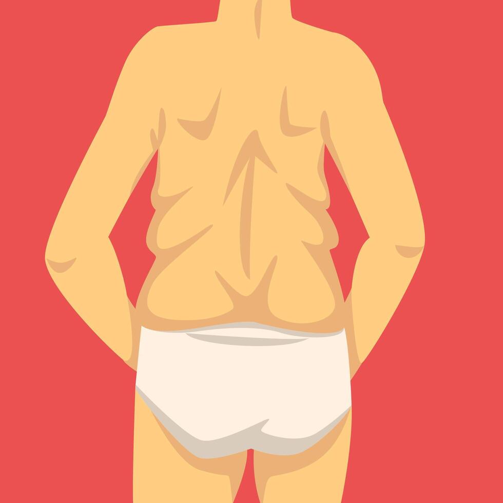 Male Torso, Human Body After Weight Loss, Back View, Obesity and Unhealthy Eating Problems Illustration vector