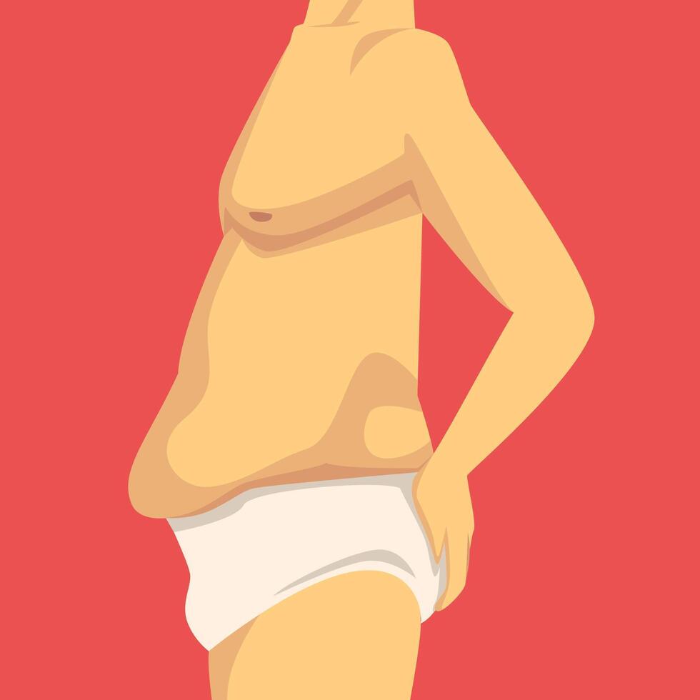 Male Torso with Sagging Fat Belly, Human Body After Weight Loss, Side View, Obesity and Unhealthy Eating Problems Illustration vector