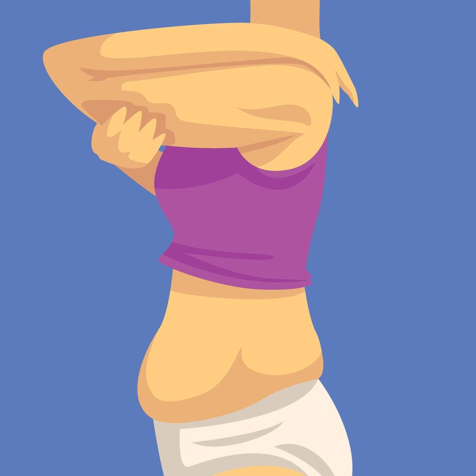 Part of Female Body, Woman Clamping Fold of Fat Forearm with Her Hand, Side View, Human Figure After Weight Loss, Obesity and Unhealthy Eating Problems Illustration vector