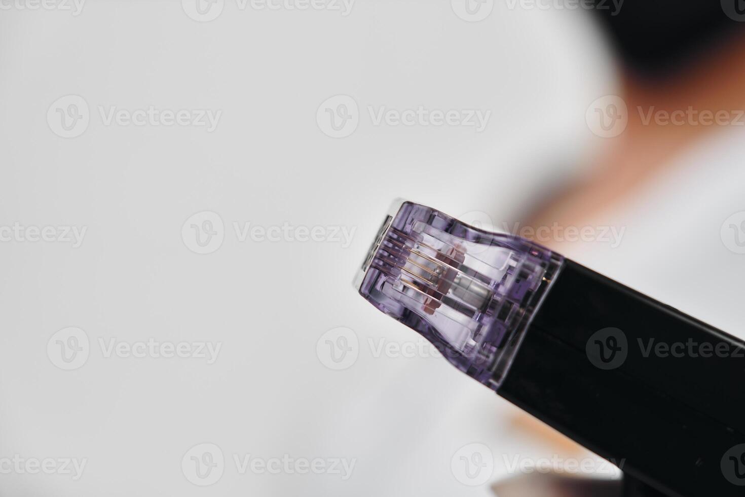 Close-up view of a microneedling device being held in a clinic setting photo