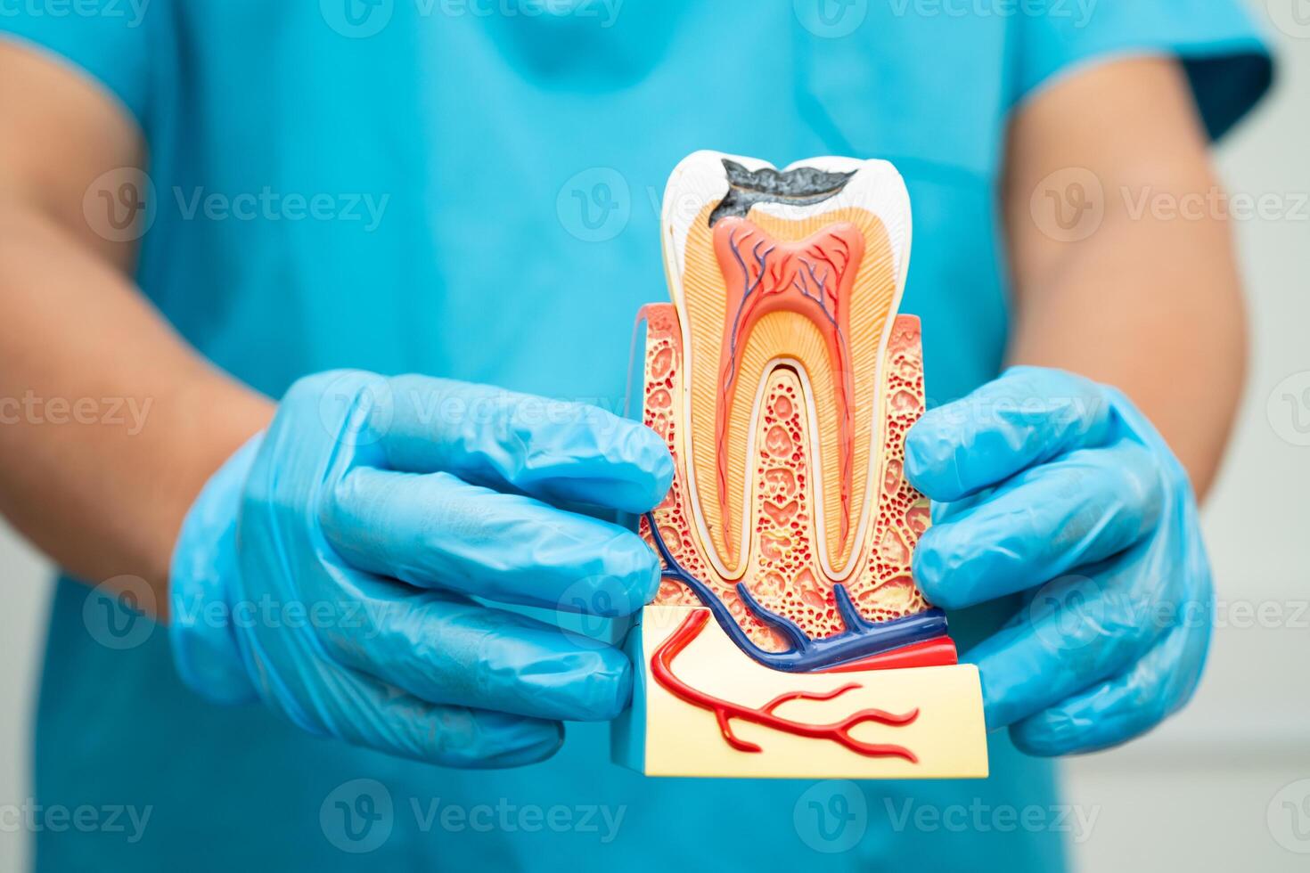 Asian dentist holding dental implant, artificial tooth roots into jaw, root canal of dental treatment, gum disease, teeth model for dentist. photo