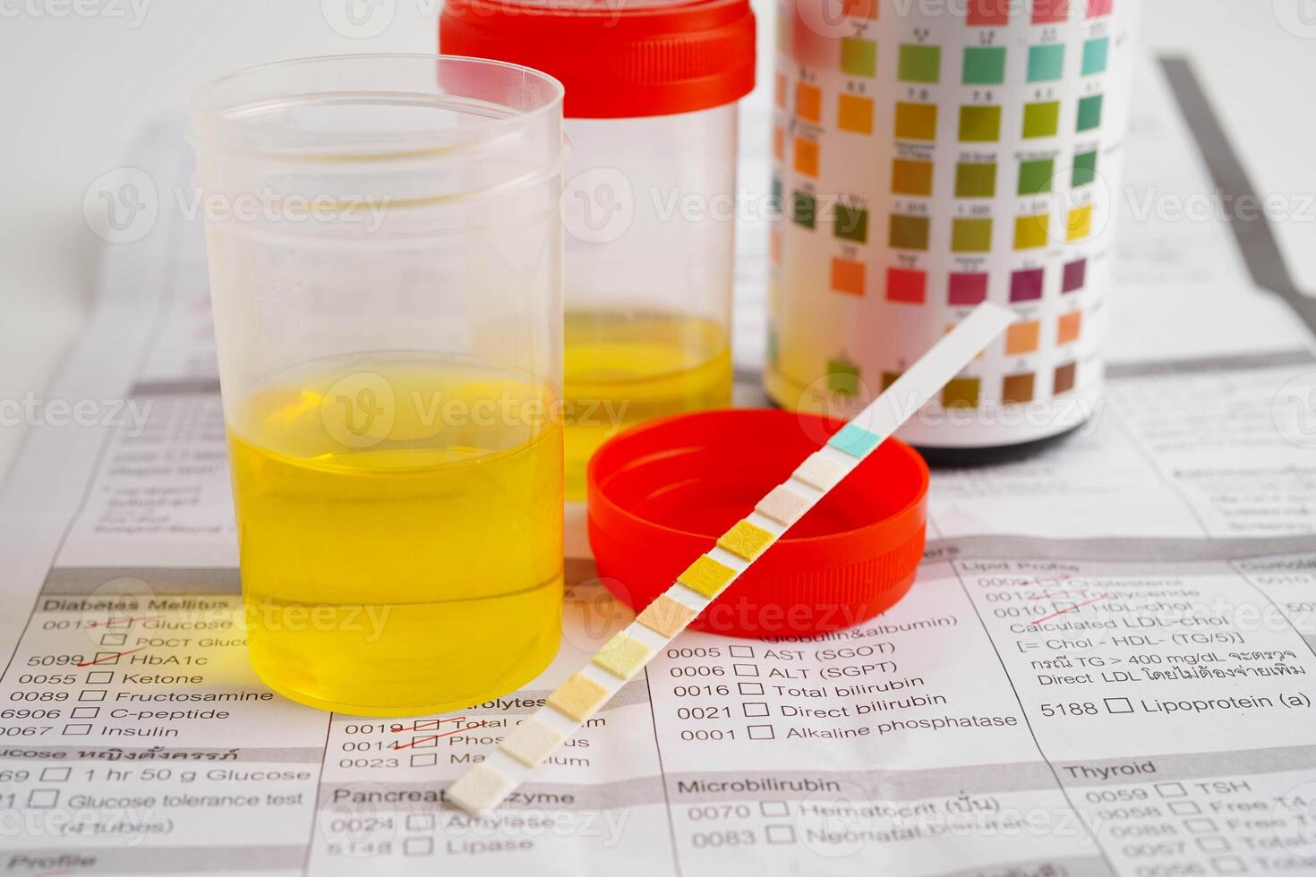 Urinalysis, urine cup with reagent strip pH paper test and comparison chart in laboratory. photo