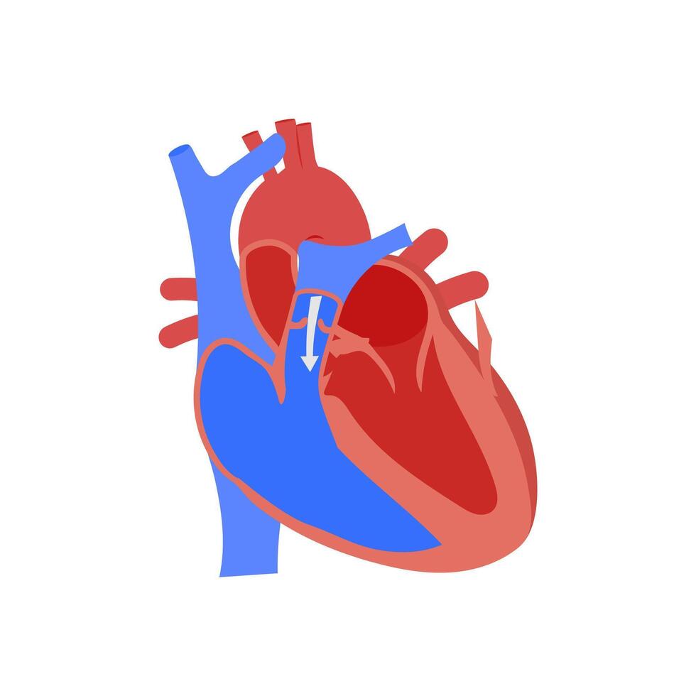 Pulmonary Regurgitation, Cardiovascular Disease Illustration Icon vector