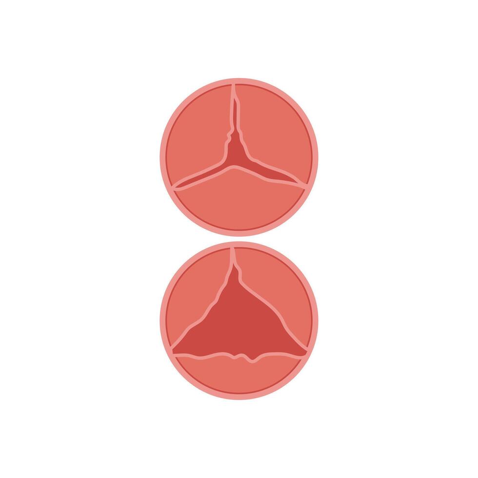 Heart Valve Disease, Cardiovascular Disease Illustration Icon vector
