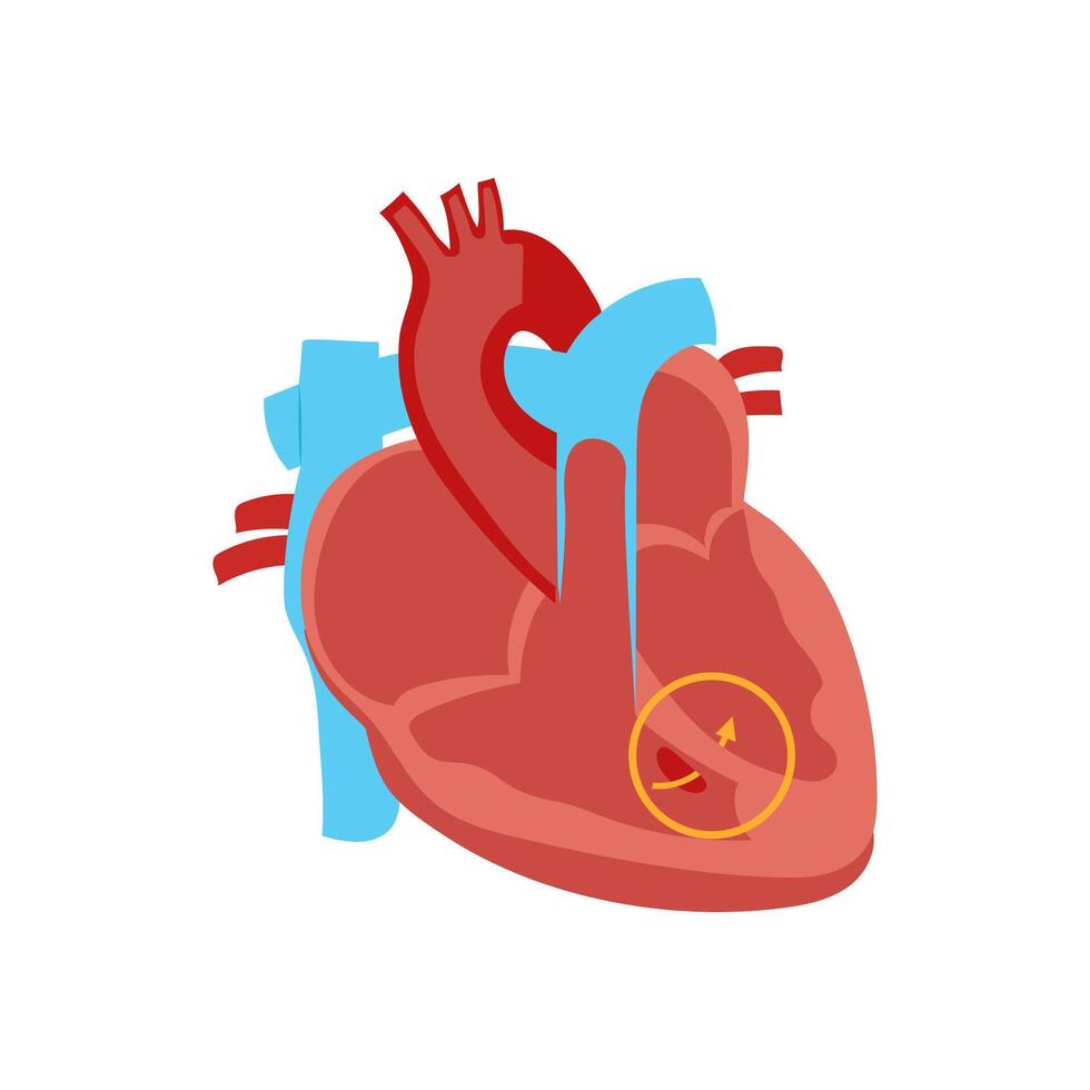 Congenital Heart Defect, Cardiovascular Disease Illustration Icon vector