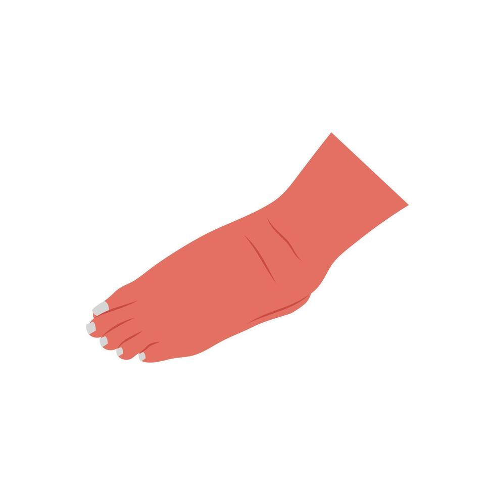 Foot Swelling, Cardiovascular Disease Illustration Icon vector