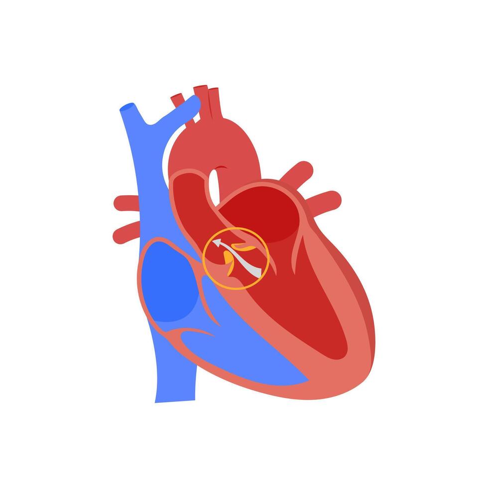 Hypotension, Cardiovascular Disease Illustration Icon vector