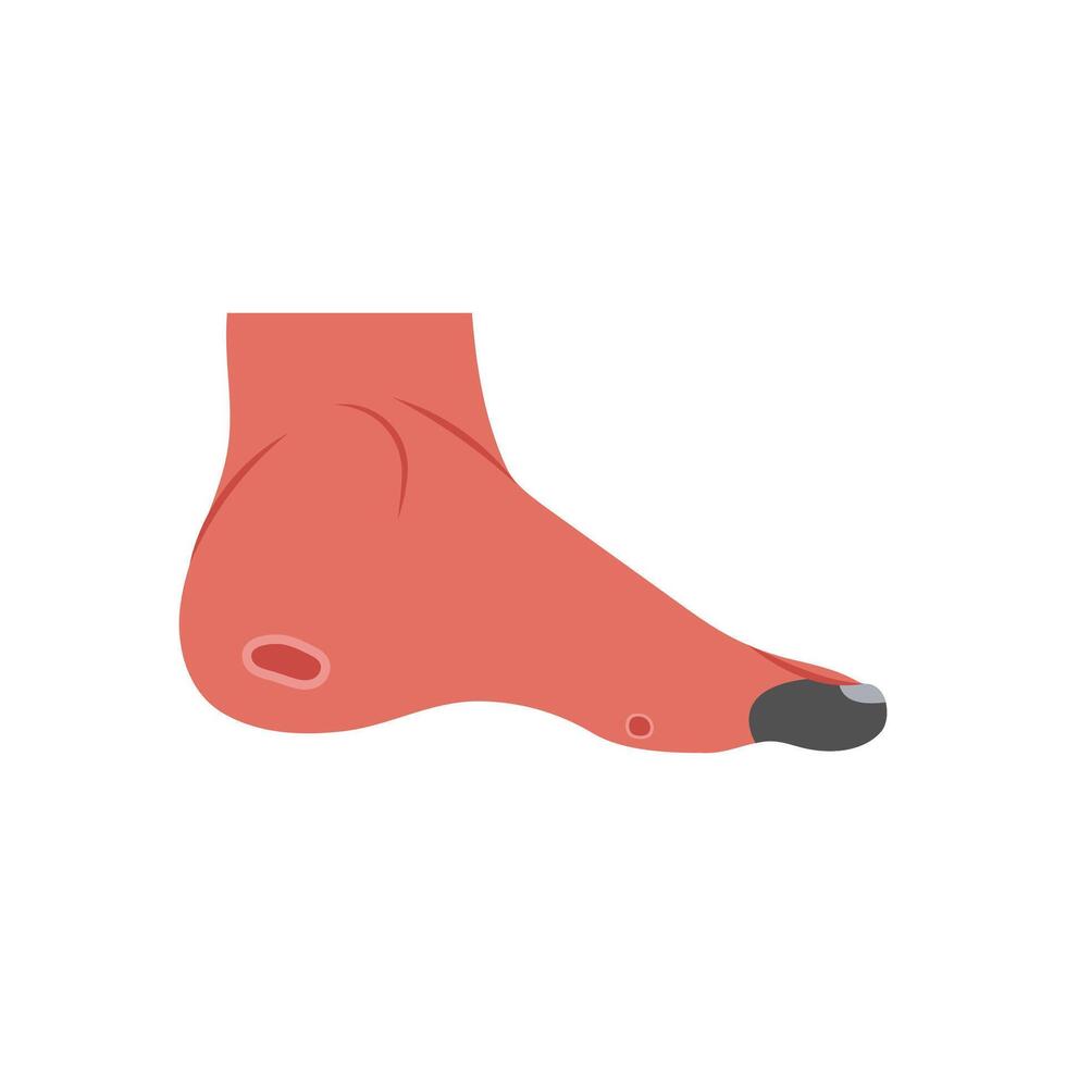 Ischemia, Cardiovascular Disease Illustration Icon vector