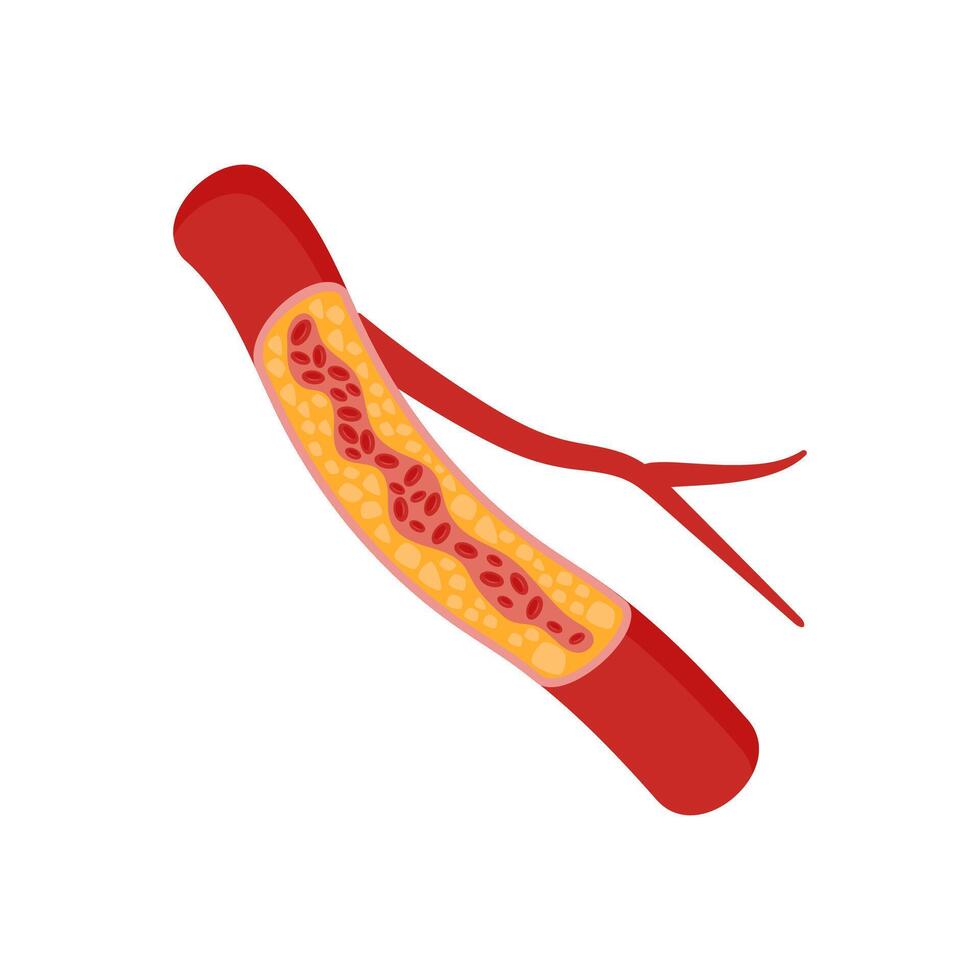 Low Density Lipoprotein, Cardiovascular Disease Illustration Icon vector