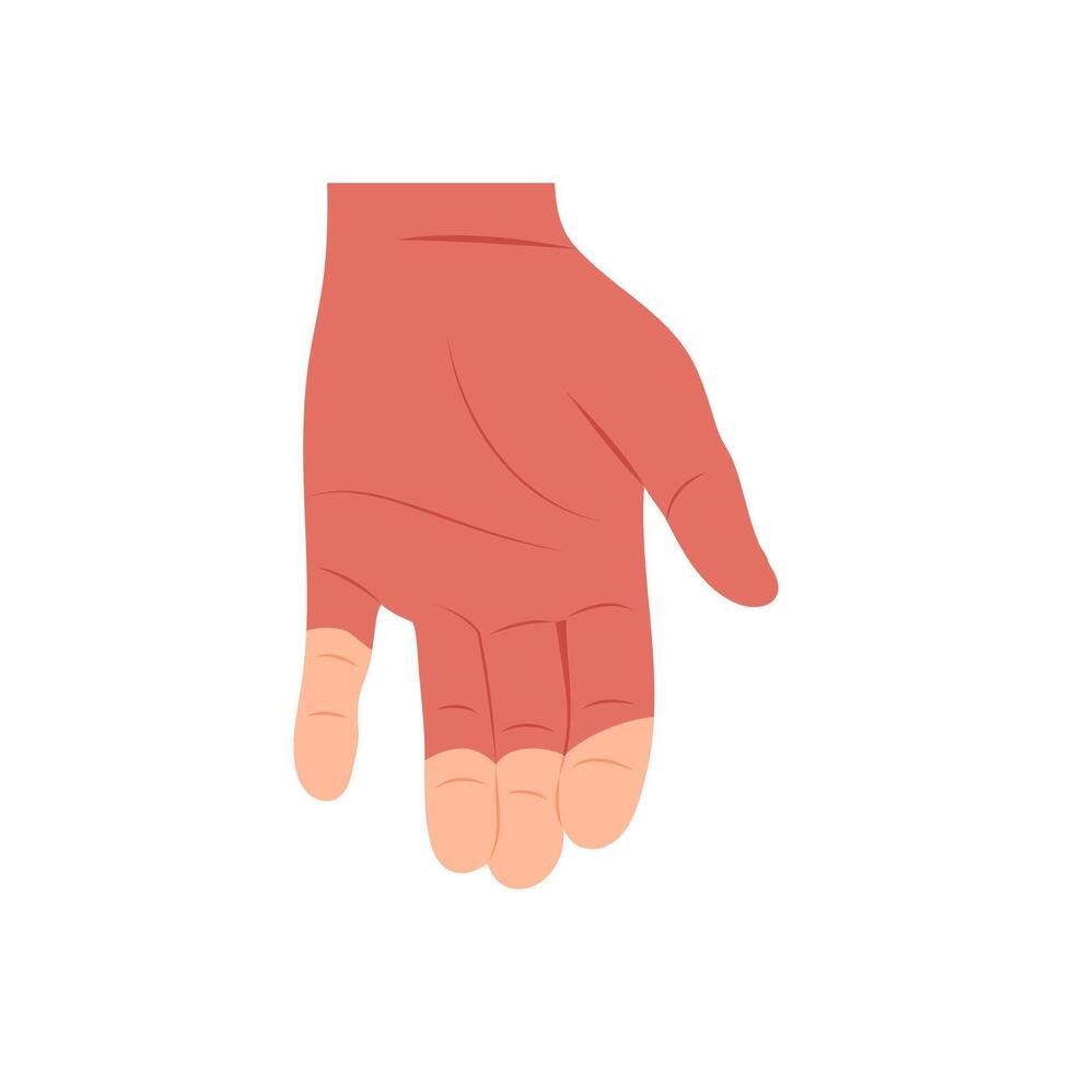 Rynauds Syndrome, Cardiovascular Disease Illustration Icon vector