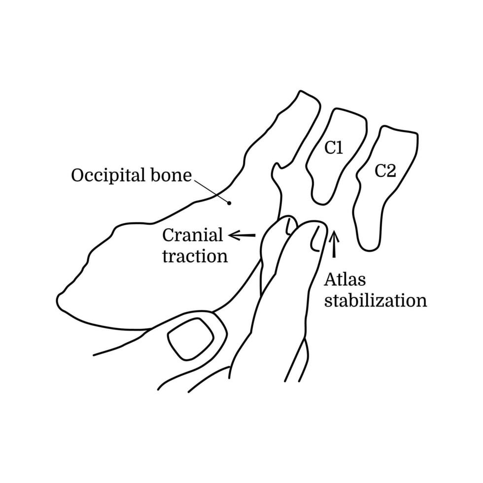 The concept of alternative medicine occipital and atlas correction. Treatment of the occipital diaphragm with hands. Craniosacral therapy session. Illustration isolated on white background vector