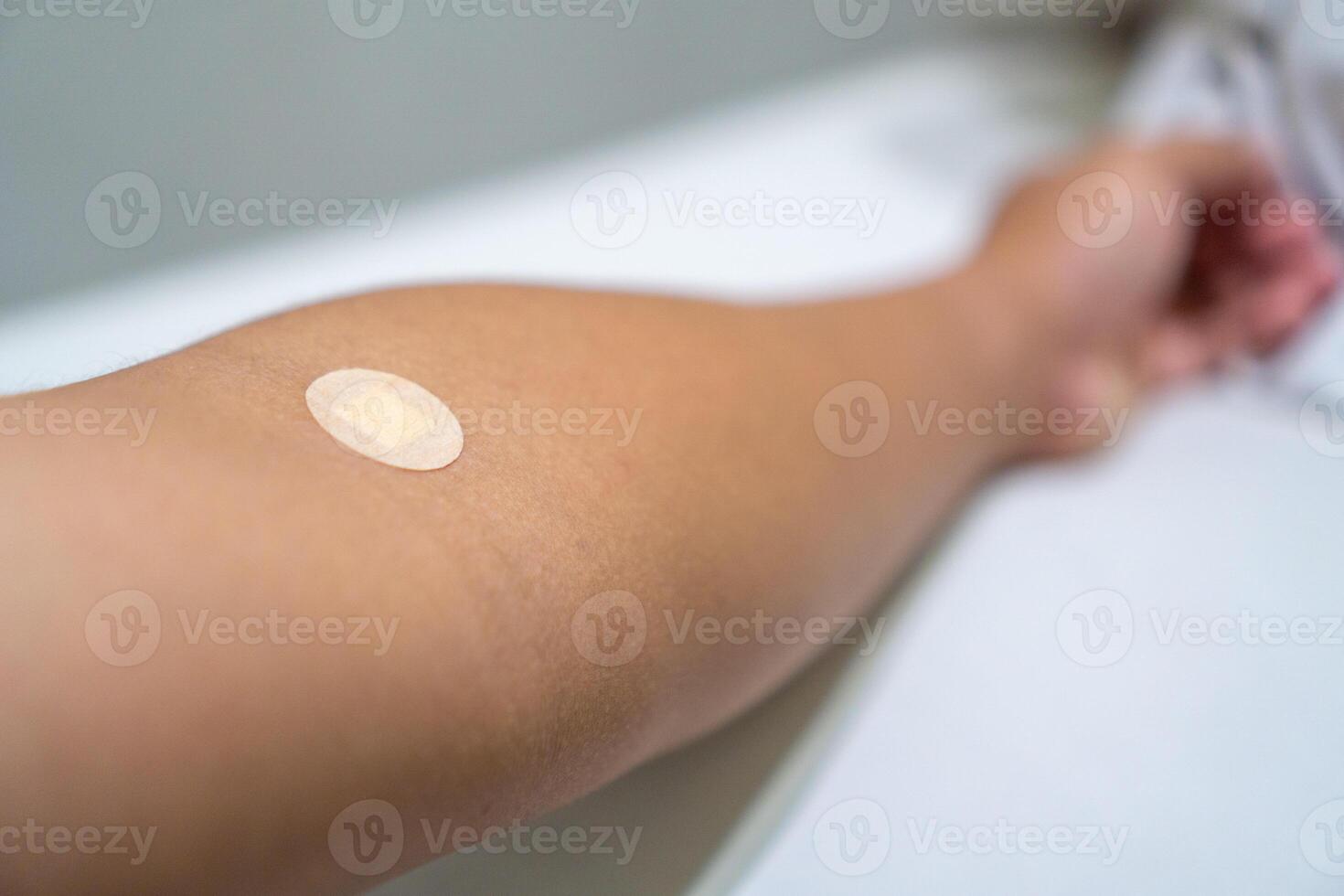 Close up of medical tape on hand.. A medical adhesive bandage is placed on the injection site after blood sample collection to prevent bleeding and maintain cleanliness. photo