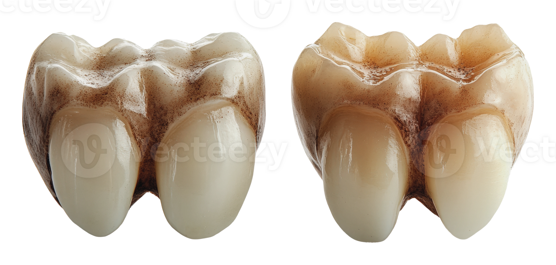 Dental restoration models for educational purposes png