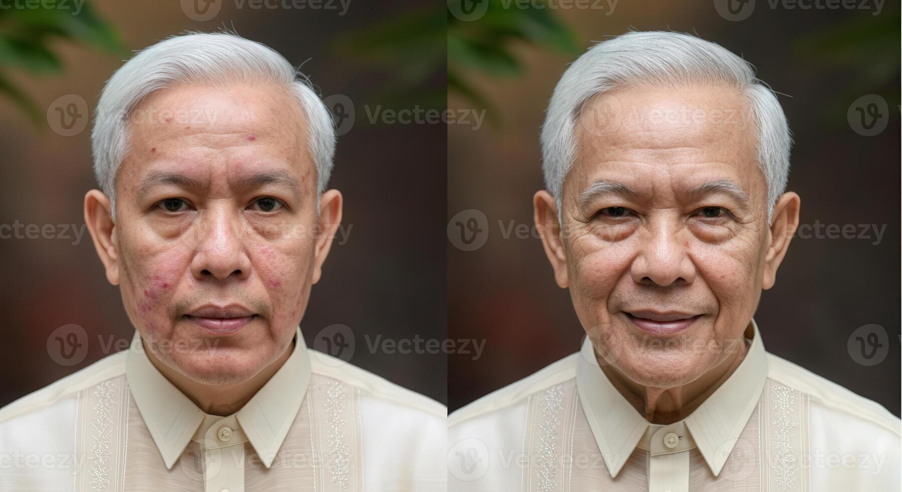 Transformation of elderly asian male before and after skincare treatment photo