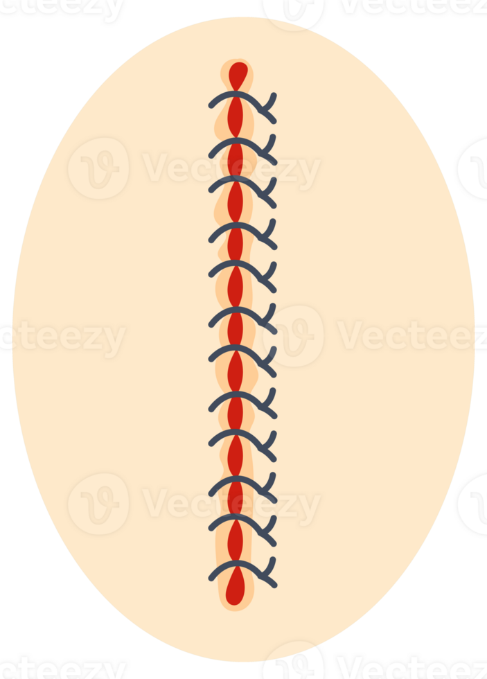 Collection of round icons representing various sutured wounds in different configurations, showing the process of surgical suture healing. png
