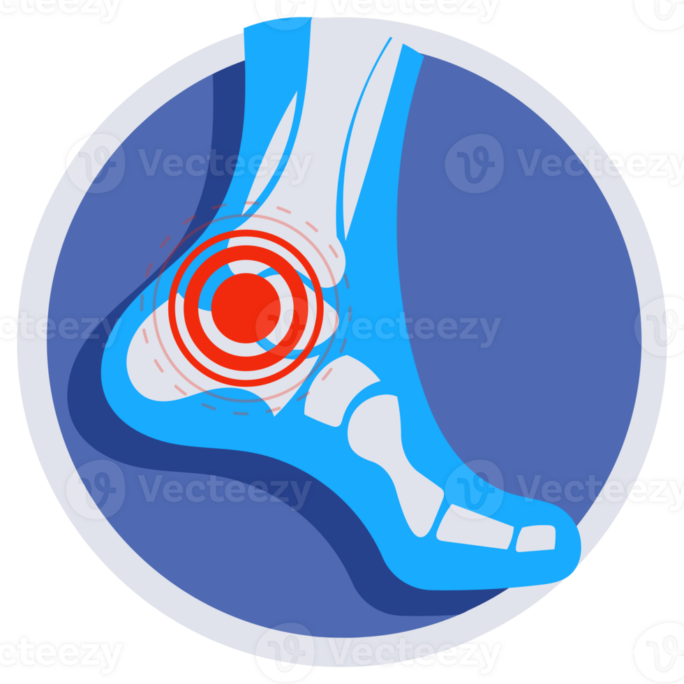 Set of joints pain icons showing symptoms of arthritis, osteoporosis, rheumatoid, gout, knee, wrist, elbow, ankle injury. png