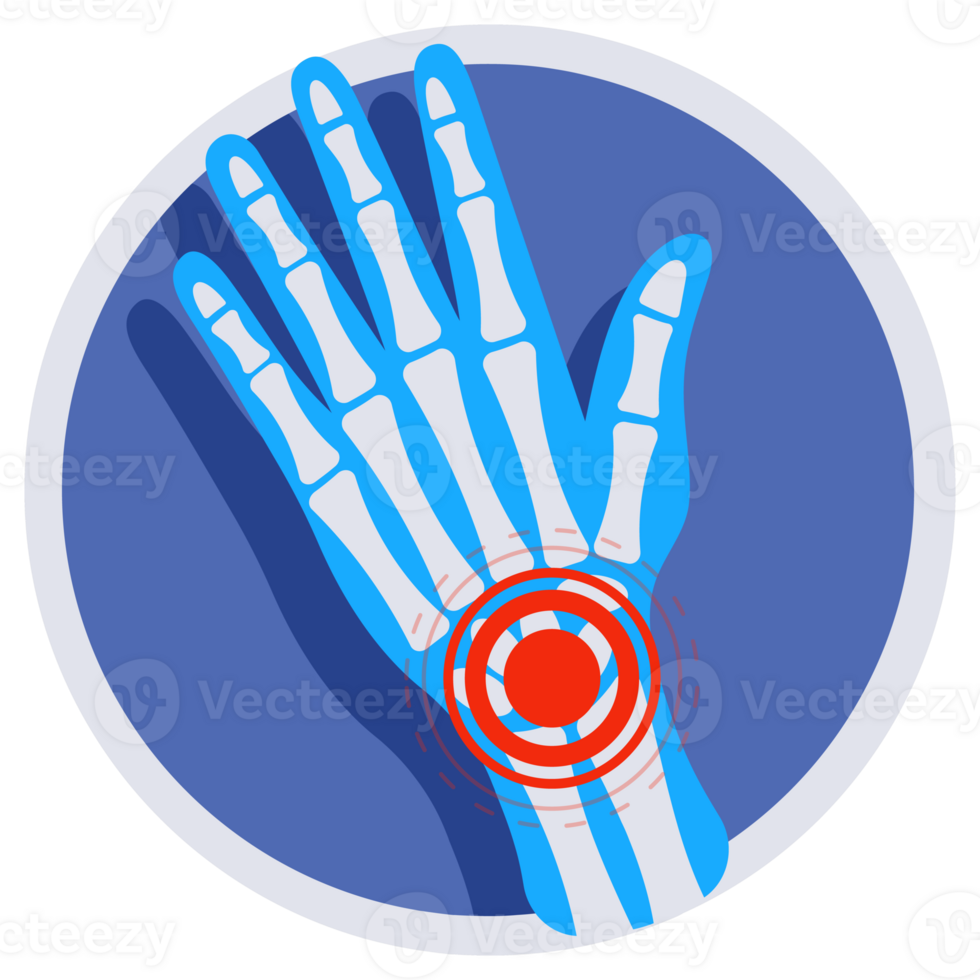 Set of joints pain icons showing symptoms of arthritis, osteoporosis, rheumatoid, gout, knee, wrist, elbow, ankle injury. png