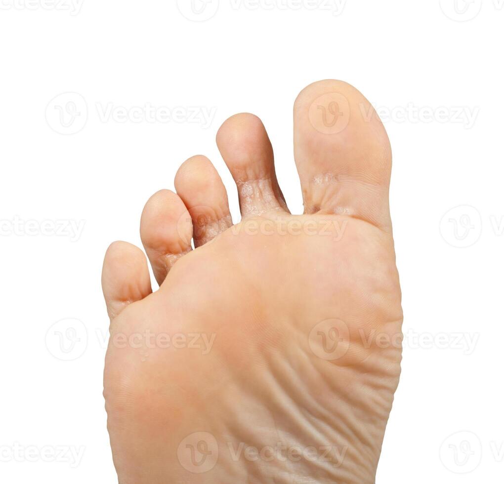 A person's foot with a white background photo
