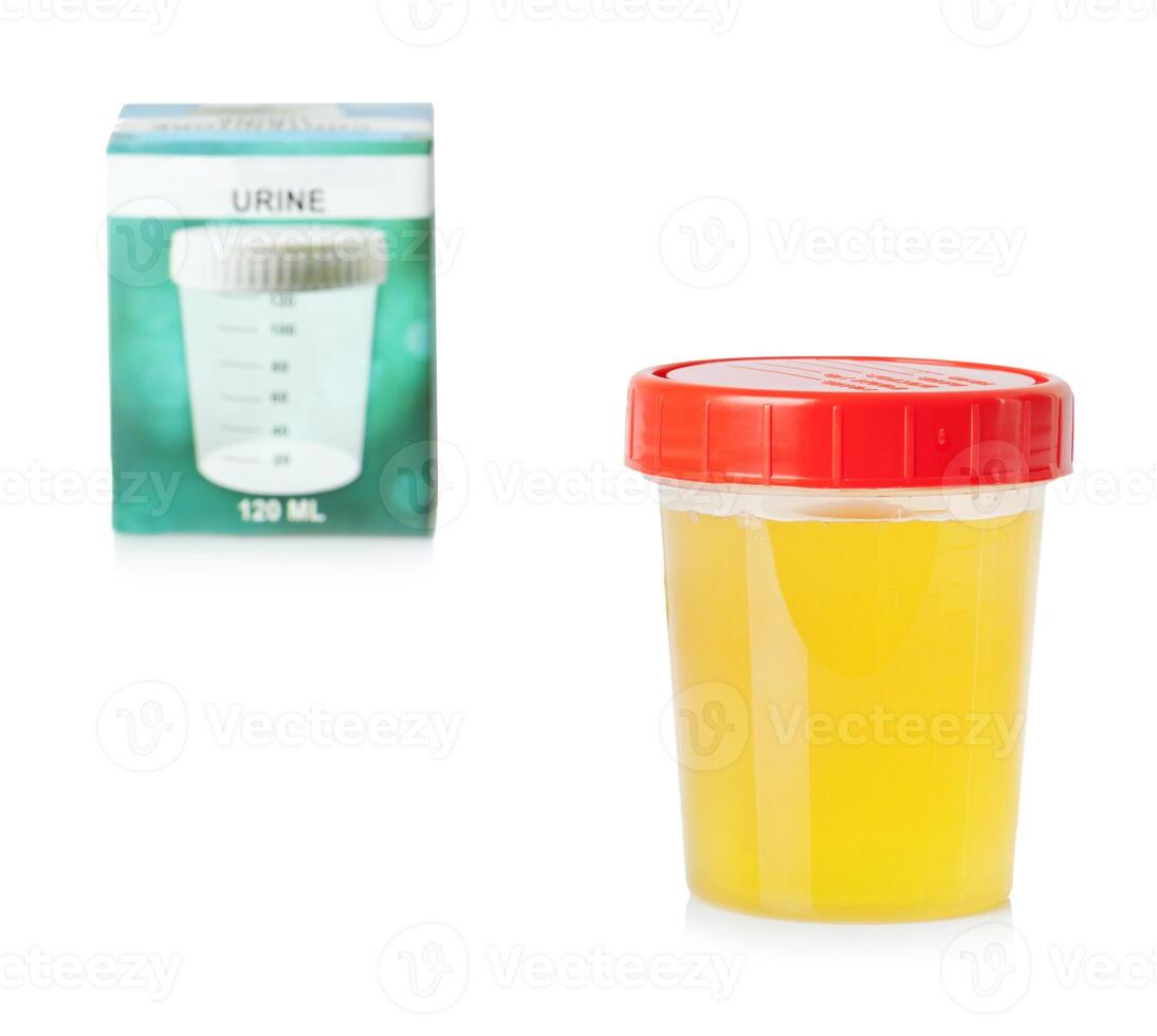 Urine sample in container photo