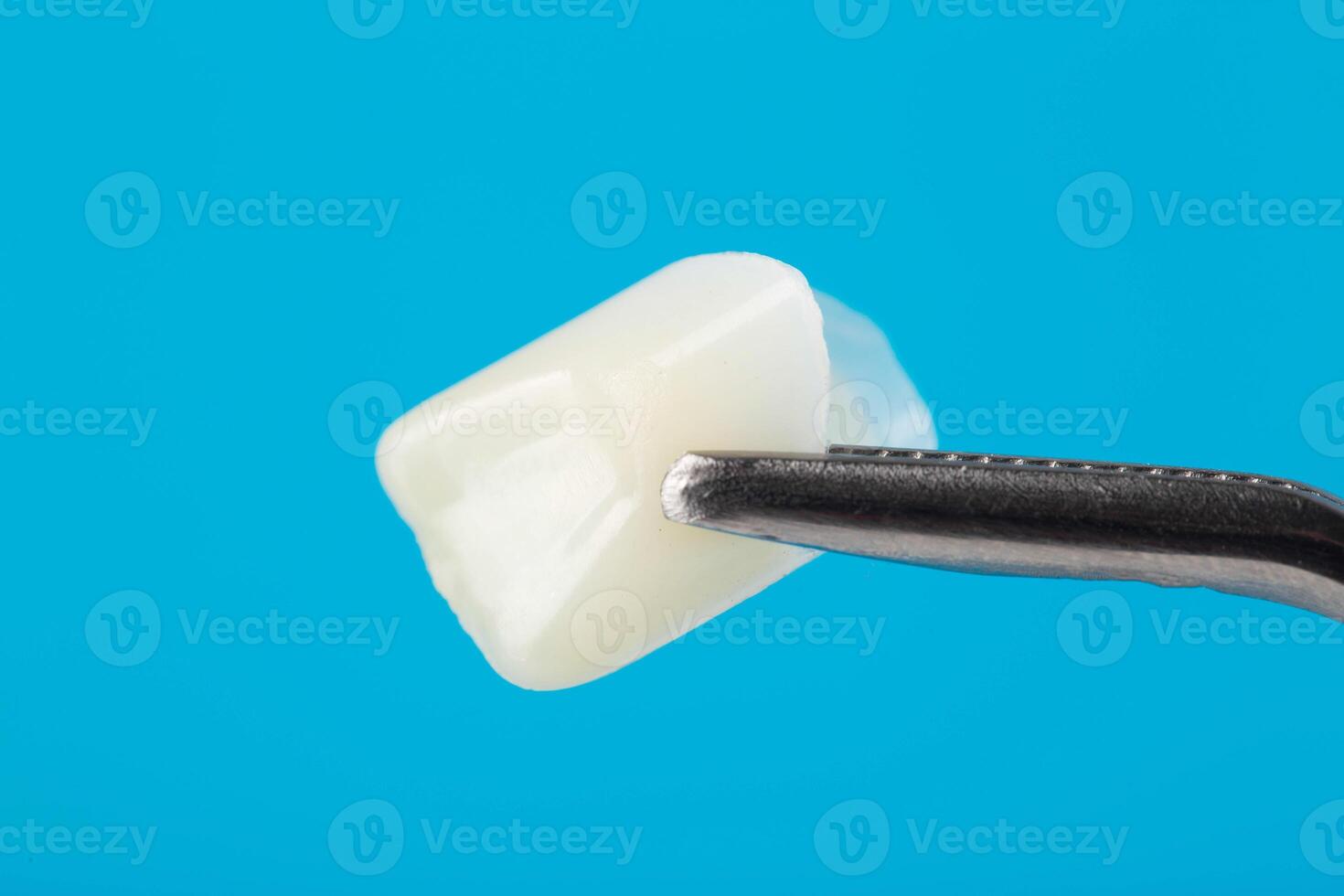 Ceramic dental crown in tweezers on a blue background, macro. The concept of dental prosthetics with crowns made of different hypoallergenic metals, aluminium oxide photo