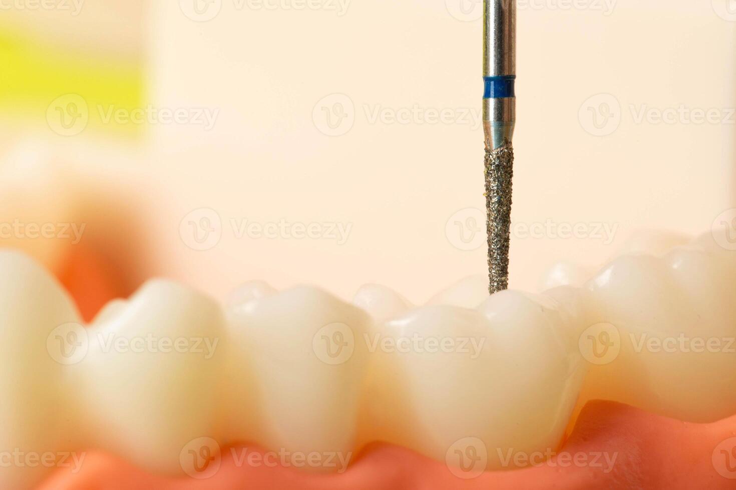 The diamond drill of the drill polishes the new filling installed on the caries and pulpitis the tooth, macro. Copy space for text, surgical dentistry photo