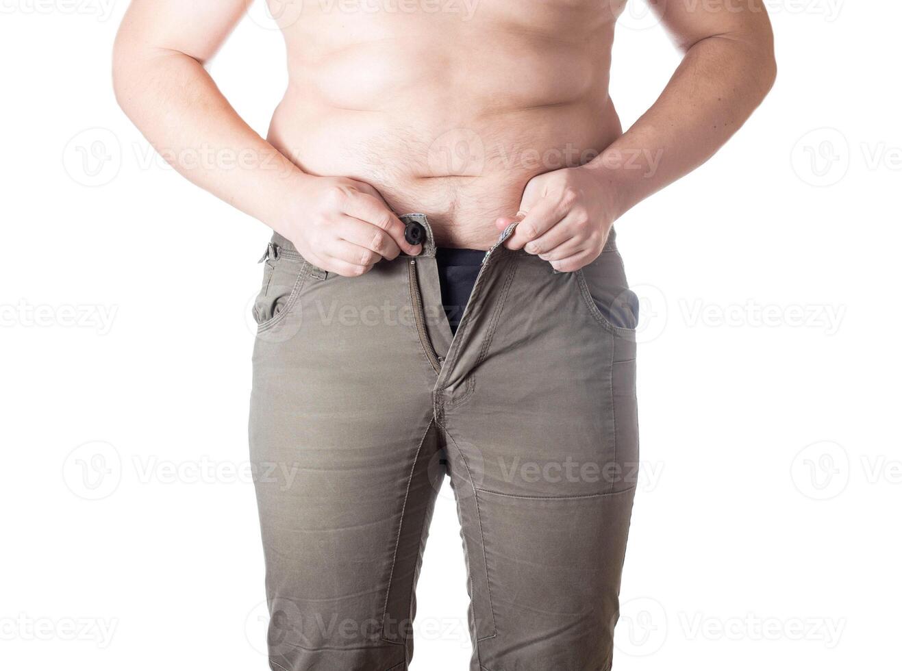 A fat man with overweight and fat folds on his stomach wears small green shorts on a white background. Obesity and malnutrition concept, diet photo