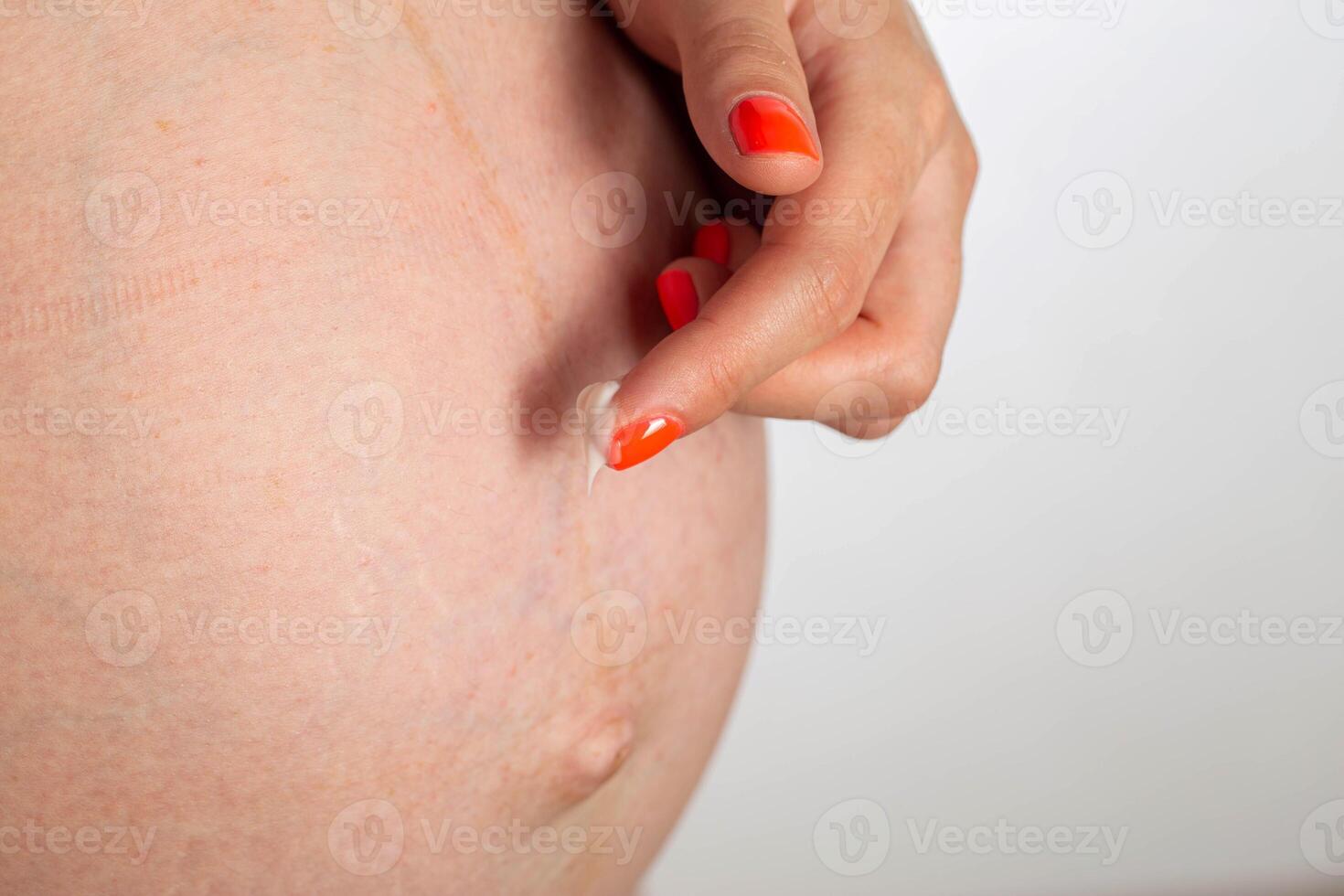 Skin care for a pregnant girl with stretch marks on her stomach. Moisturizing cream with vitamins for skin care in pregnant women. Close-up photo