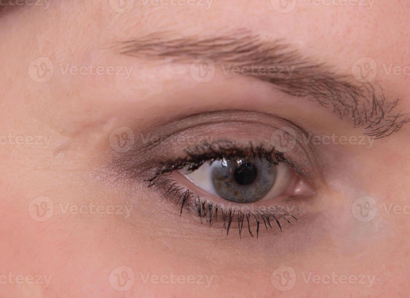 Large scar near the eye on the caucasian girl's face, close-up, cosmetology photo
