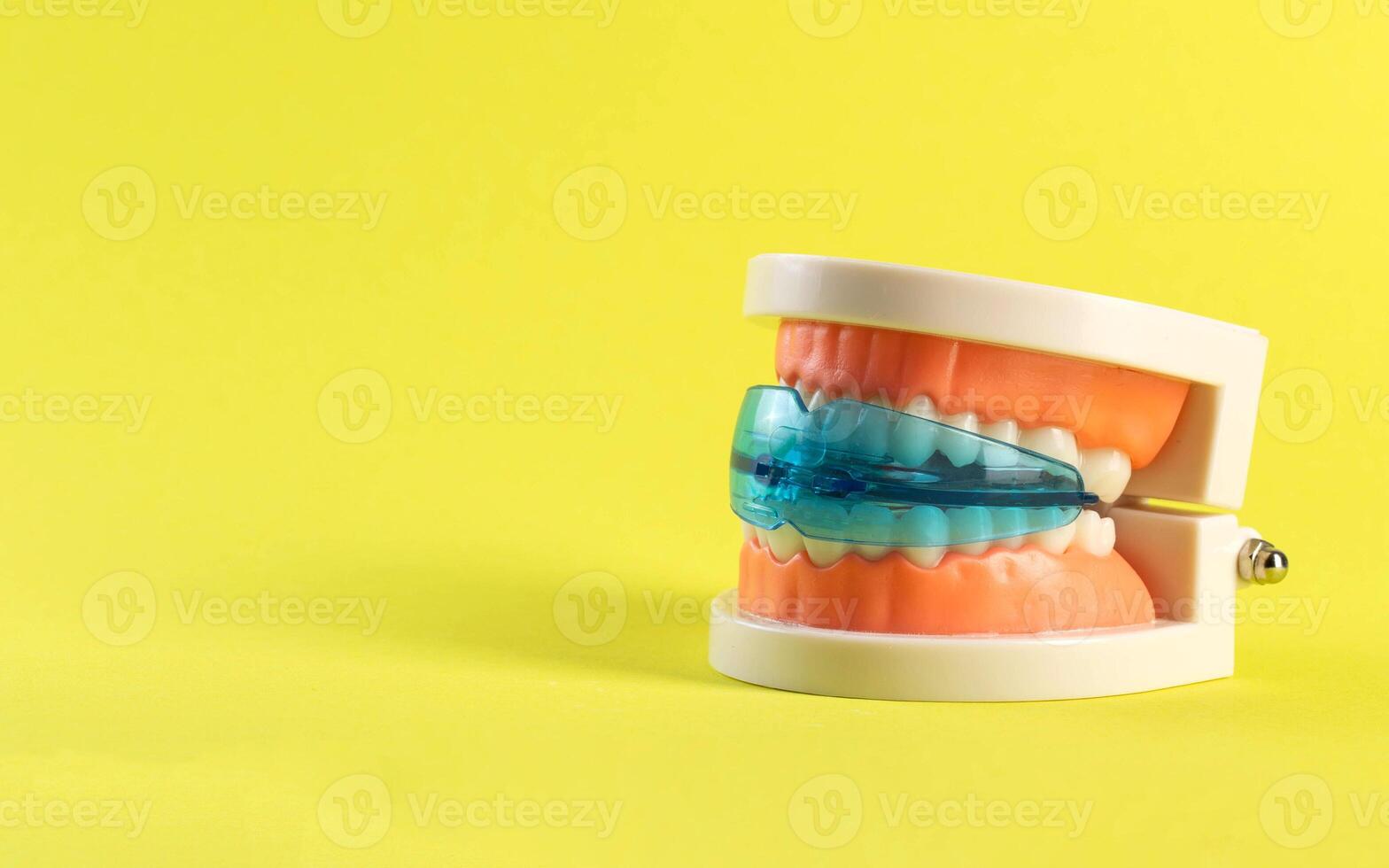 Dental mouth guard for bruxism with a mock-up of a dental jaw on a yellow background. Concept for treatment and protection of teeth from grinding during sleep in children. photo